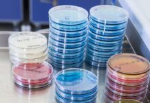 Zoonosi e Salmonella nel settore avicolo: cosa dicono i dati UE e italiani 2024