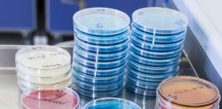 Zoonosi e Salmonella nel settore avicolo: cosa dicono i dati UE e italiani 2024